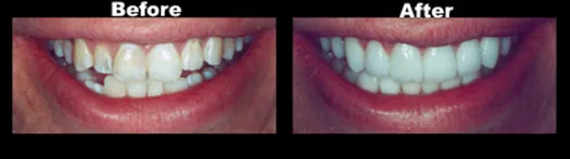 Case_1